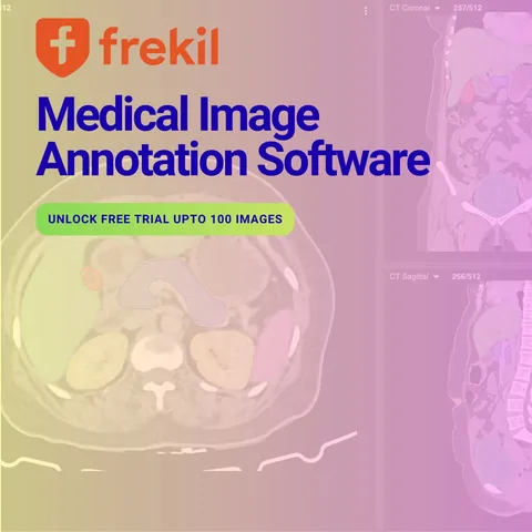 An ad Frekil is running